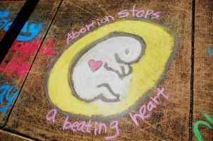 Chalking- Preborn Baby